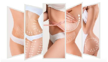 Dr. Amita Bharti of Reshapeyou Clinic offers the best lipolysis treatment in Patna for body reshaping.